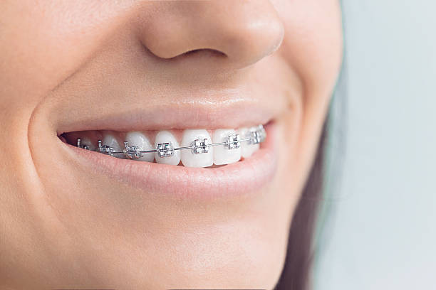 Best Dental Fillings (Composite and Amalgam)  in Cactus, TX